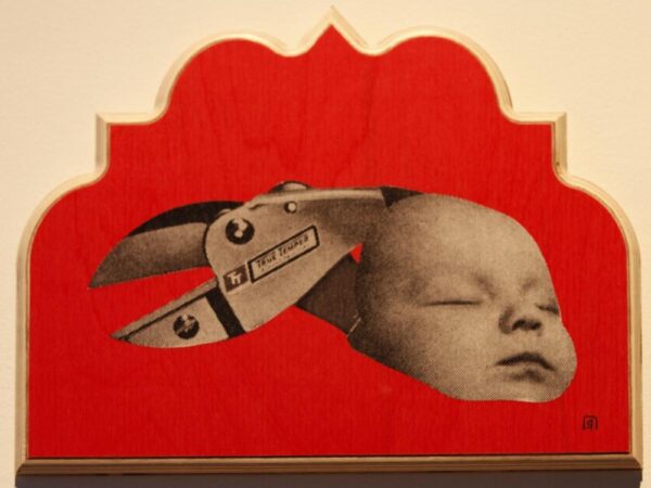 Circumcision or Vasectomy